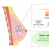 影響因子12.31！中國專家提出乳腺癌腫瘤干細(xì)胞治療開拓性研究視角
